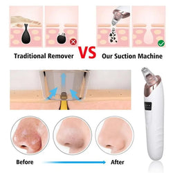 Derma suction vacuum Blackhead Remover /Face Deep Cleaning Skin Care/Skin Care Tool