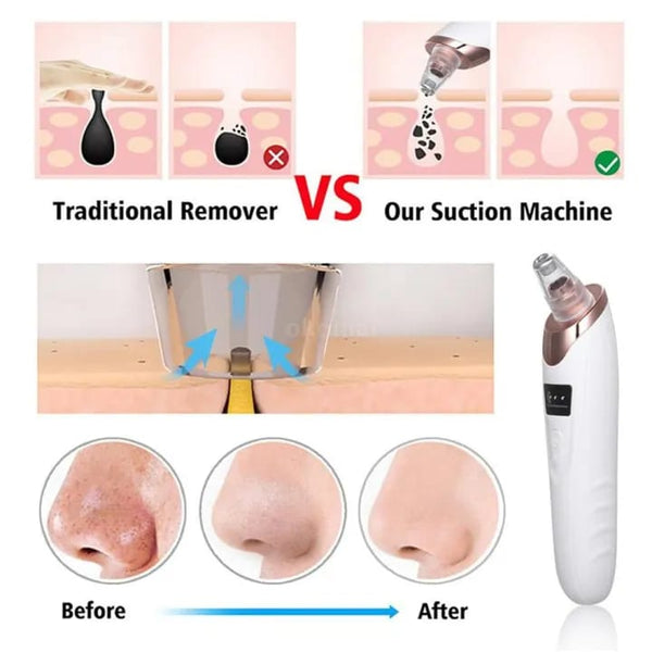 Derma suction vacuum Blackhead Remover /Face Deep Cleaning Skin Care/Skin Care Tool